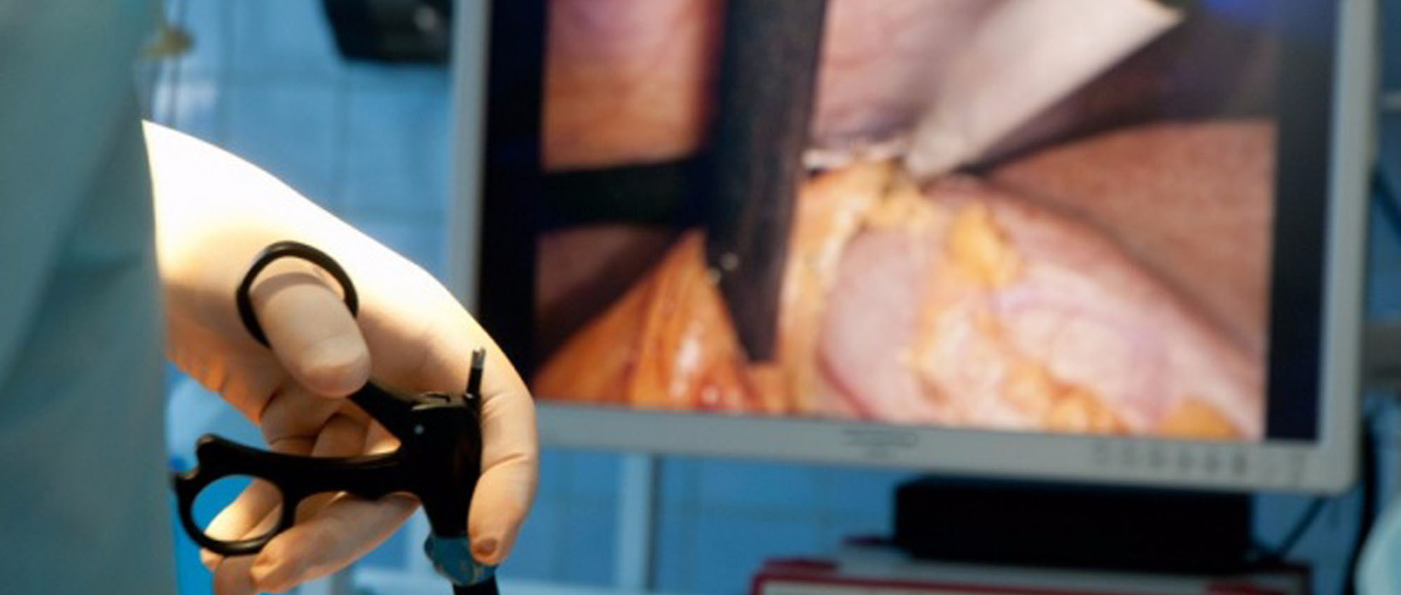 Colonoscopy procedures in Plettenberg Bay